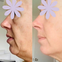 Thumbnail for Anti-Aging HIFU, EMS and Microcurrent 2.0, Skin Tightening, Anti-Aging, Lifting, Firming, Toning, Wrinkle Remover - Epic Trends and Gifts-Massager-Anti-Aging HIFU, EMS and Microcurrent 2.0, Skin Tightening, Anti-Aging, Lifting, Firming, Toning, Wrinkle Remover