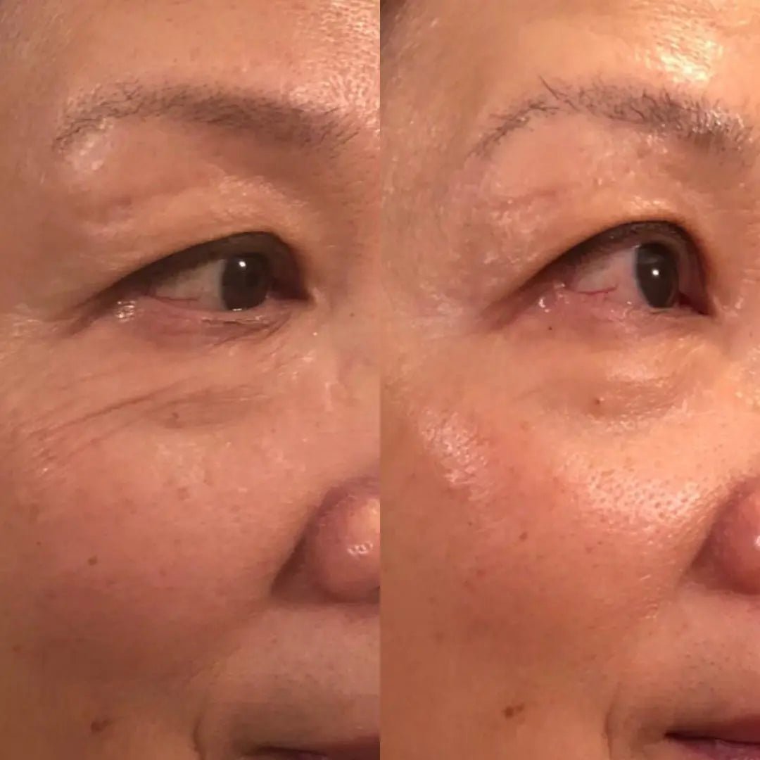 Anti - Aging HIFU, EMS and Microcurrent 2.0, Wrinkle Remover - Epic Trends and Gifts - Massager - Anti - Aging HIFU, EMS and Microcurrent 2.0, Skin Tightening, Anti - Aging, Lifting, Firming, Toning, Wrinkle Remover - Epic Trends and Gifts - Massager - Anti - Aging HIFU, EMS and Microcurrent 2.0, Skin Tightening, Anti - Aging, Lifting, Firming, Toning, Wrinkle Remover