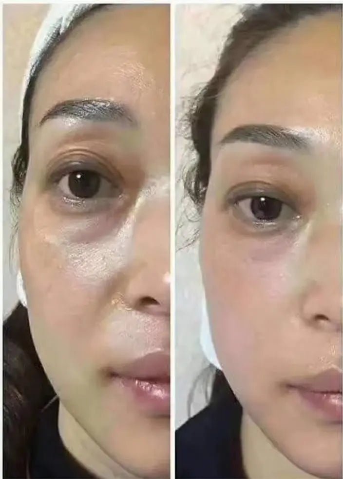 Anti - Aging HIFU, EMS and Microcurrent 2.0, Wrinkle Remover - Epic Trends and Gifts - Massager - Anti - Aging HIFU, EMS and Microcurrent 2.0, Skin Tightening, Anti - Aging, Lifting, Firming, Toning, Wrinkle Remover - Epic Trends and Gifts - Massager - Anti - Aging HIFU, EMS and Microcurrent 2.0, Skin Tightening, Anti - Aging, Lifting, Firming, Toning, Wrinkle Remover