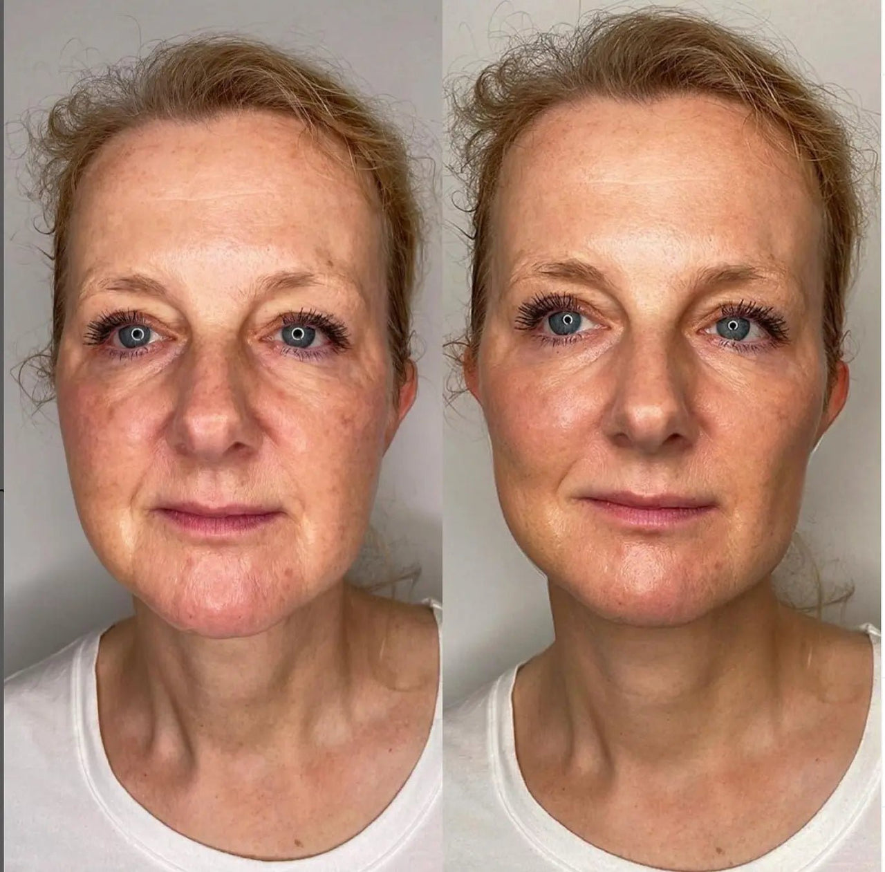 Anti - Aging HIFU, EMS and Microcurrent 2.0, Wrinkle Remover - Epic Trends and Gifts - Massager - Anti - Aging HIFU, EMS and Microcurrent 2.0, Skin Tightening, Anti - Aging, Lifting, Firming, Toning, Wrinkle Remover - Epic Trends and Gifts - Massager - Anti - Aging HIFU, EMS and Microcurrent 2.0, Skin Tightening, Anti - Aging, Lifting, Firming, Toning, Wrinkle Remover