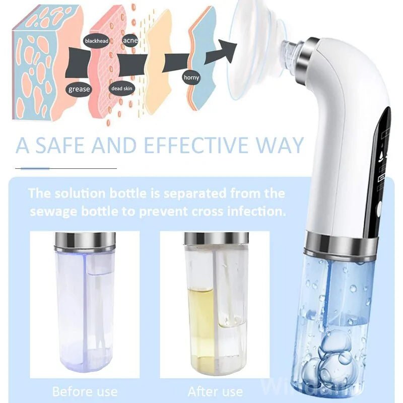 Blackhead Remover, Pore Vacuum Cleaner - Epic Trends and Gifts - Skin Care - Blackhead Remover, Pore Vacuum Cleaner