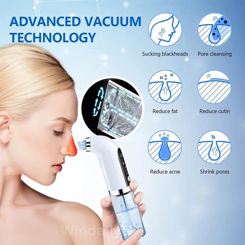 Blackhead Remover, Pore Vacuum Cleaner - Epic Trends and Gifts - Skin Care - Blackhead Remover, Pore Vacuum Cleaner