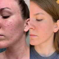 Thumbnail for Chroma Glow Pro 7 - Spectrum Light Therapy Facial Mask - Epic Trends and Gifts - Skin Care Tools - Chroma Glow Pro 7 - Spectrum Light Therapy Facial Mask - Epic Trends and Gifts - Facial Mask - Chroma Glow Pro 7 - Spectrum Light Therapy Facial Mask