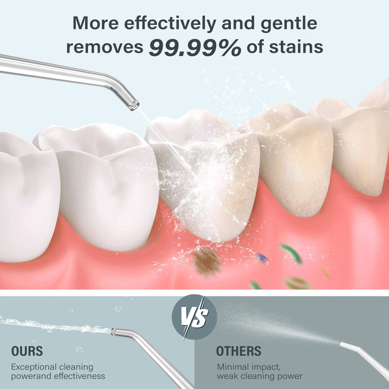 Dental Oral Irrigator Water Flosser - Epic Trends and Gifts - Oral Care - S99e02d46c40f4d38a70a549b069fe835U