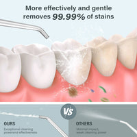 Thumbnail for Dental Oral Irrigator Water Flosser - Epic Trends and Gifts - Oral Care - S99e02d46c40f4d38a70a549b069fe835U