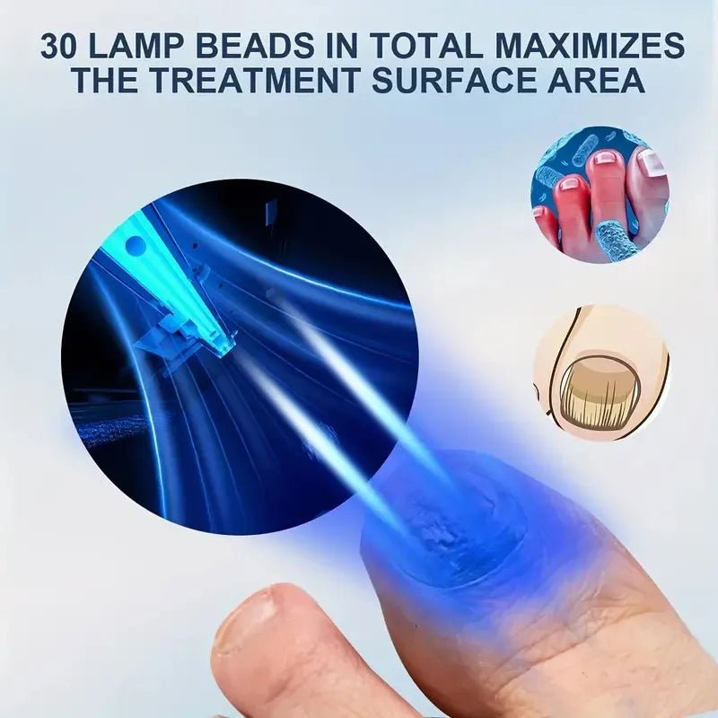 Effective Nail Fungus Laser Treatment - Blue Therapy Device - Epic Trends and Gifts - Nail Care Tools - S69944d27ba484c76a638d8cdc3e1d4eal