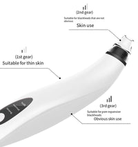 Thumbnail for Electric Blackhead Remover with Diamond Suction for Pore Cleansing - Epic Trends and Gifts - Skin Care Tools - Professional Product Title: 