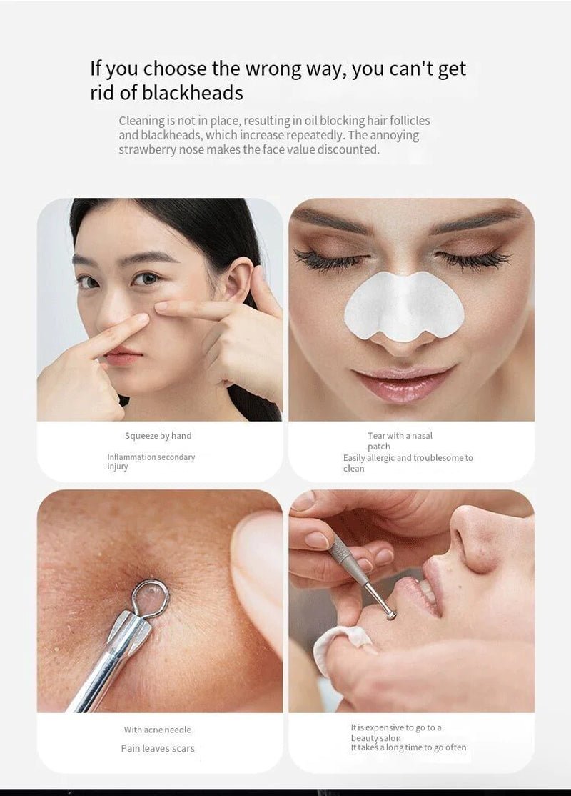 Electric Blackhead Remover with Diamond Suction for Pore Cleansing - Epic Trends and Gifts - Skin Care Tools - Professional Product Title: "Electric Blackhead Remover with Diamond Suction for Pore Cleansing"