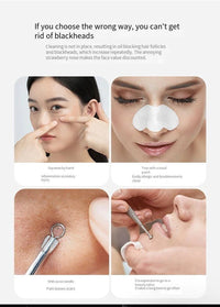 Thumbnail for Electric Blackhead Remover with Diamond Suction for Pore Cleansing - Epic Trends and Gifts - Skin Care Tools - Professional Product Title: 