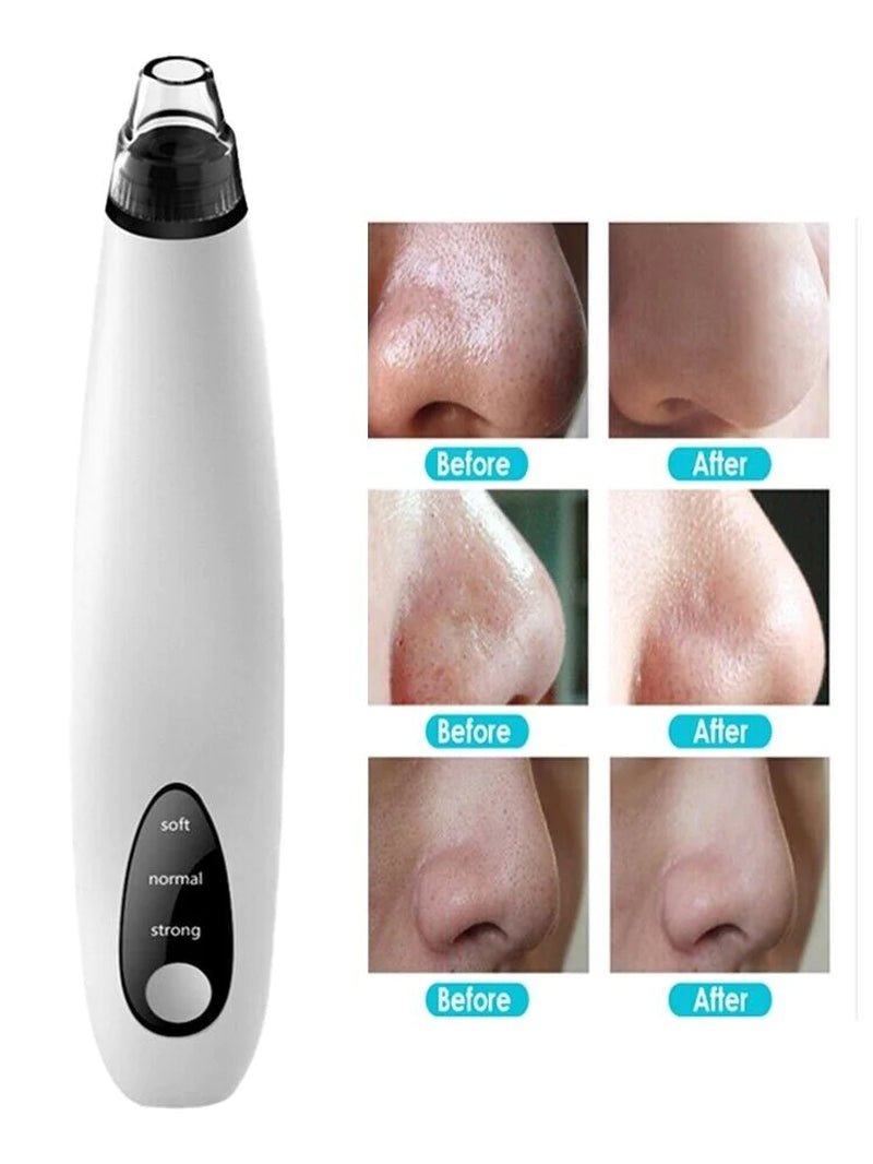 Electric Blackhead Remover with Diamond Suction for Pore Cleansing - Epic Trends and Gifts - Skin Care Tools - Professional Product Title: "Electric Blackhead Remover with Diamond Suction for Pore Cleansing"