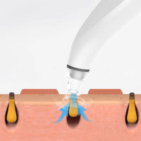 Thumbnail for Electric Blackhead Remover with Diamond Suction for Pore Cleansing - Epic Trends and Gifts - Skin Care Tools - Professional Product Title: 