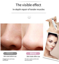 Thumbnail for Electric Blackhead Remover with Diamond Suction for Pore Cleansing - Epic Trends and Gifts - Skin Care Tools - Professional Product Title: 