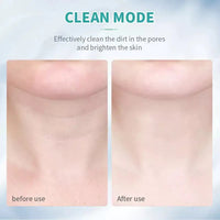 Thumbnail for Neck, Face Sculptor Beauty Device, Facial Massager, Skin Care Beauty Tools, 3 Color Led, Red Therapy Light for Face, Chin Lifting Sculpting Tool - Epic Trends and Gifts - Health & Beauty - YouthGlow SkinSculptor - Epic Trends and Gifts - Massagers - YouthGlow SkinSculptor