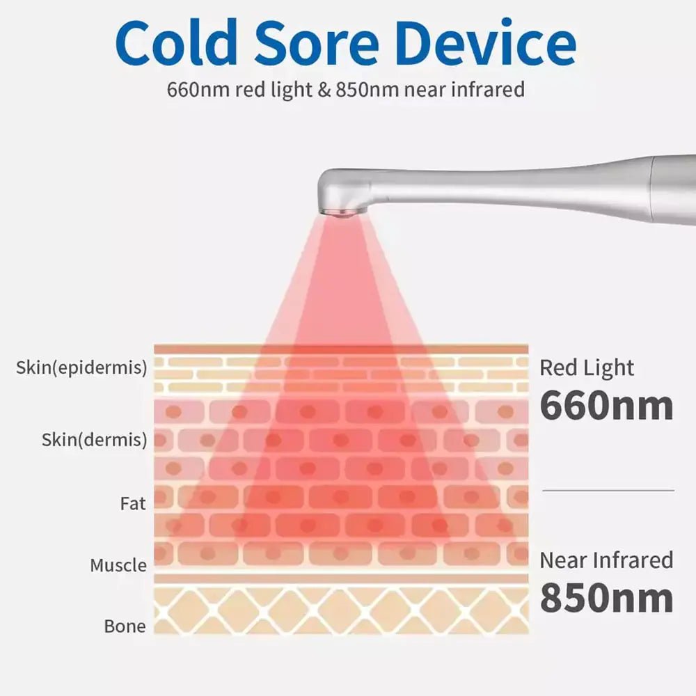 Red Light Therapy Wand Device •Treatment for Fever Blister, Canker Sore Mouth Sore Relief - Epic Trends and Gifts - Red Light Therapy - Red Light Therapy Wand Device •Treatment for Fever Blister, Canker Sore Mouth Sore Relief