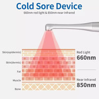 Thumbnail for Red Light Therapy Wand Device •Treatment for Fever Blister, Canker Sore Mouth Sore Relief - Epic Trends and Gifts - Red Light Therapy - Red Light Therapy Wand Device •Treatment for Fever Blister, Canker Sore Mouth Sore Relief