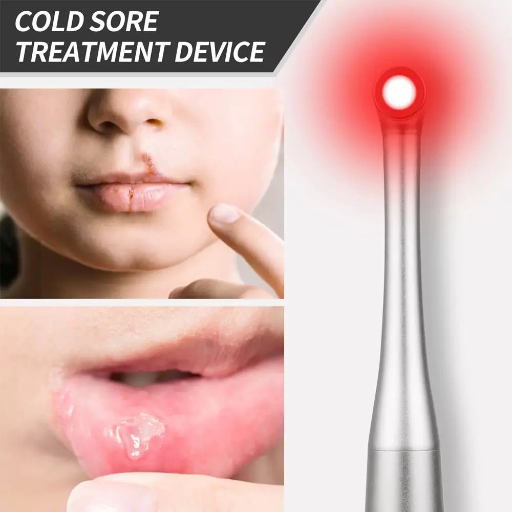 Red Light Therapy Wand Device •Treatment for Fever Blister, Canker Sore Mouth Sore Relief - Epic Trends and Gifts - Red Light Therapy - Red Light Therapy Wand Device •Treatment for Fever Blister, Canker Sore Mouth Sore Relief
