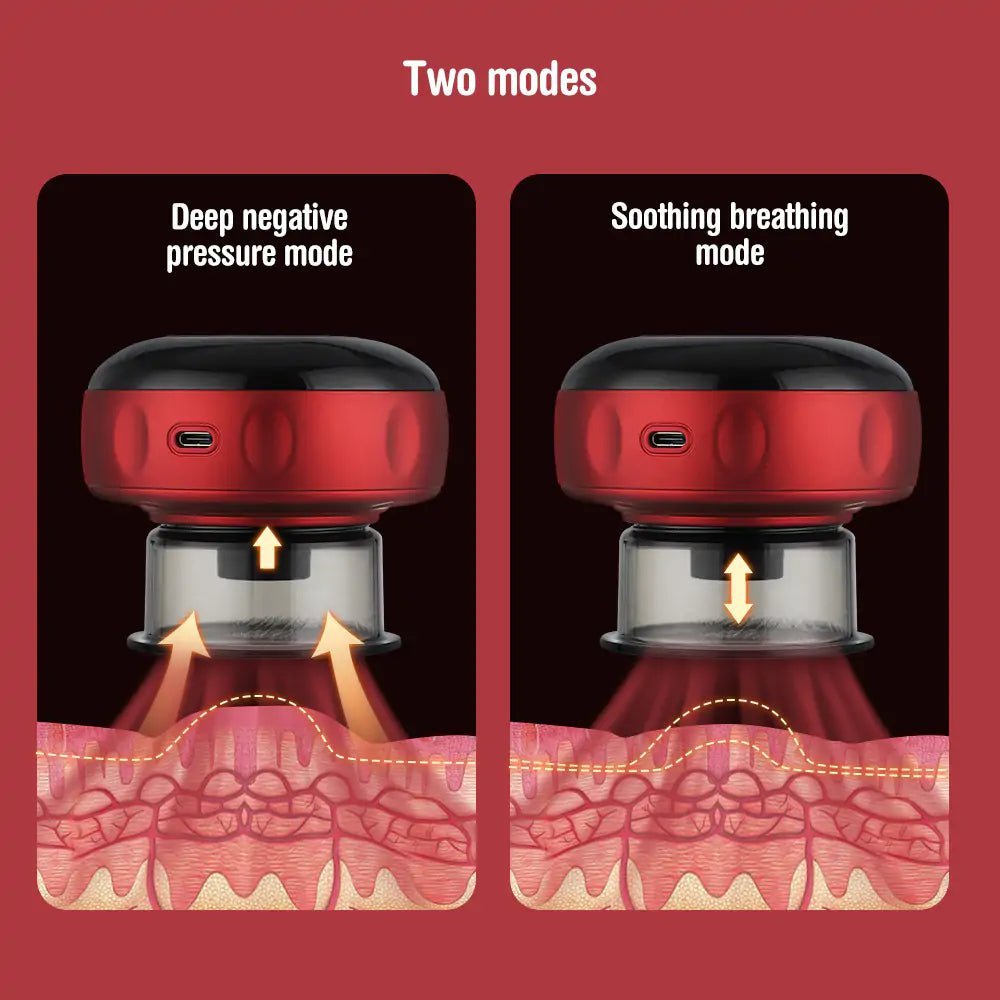 Smart Cupping Therapy Massager, Red Light Therapy for Targeted Pain Relief - Epic Trends and Gifts - Electric Massager - Electric Cupping Massager - Epic Trends and Gifts - Health & Beauty - Electric Cupping Massager